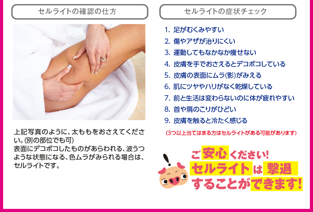セルライトの確認の仕方 セルライトの症状チェック ご安心ください!セルライトは撃退することができます!!