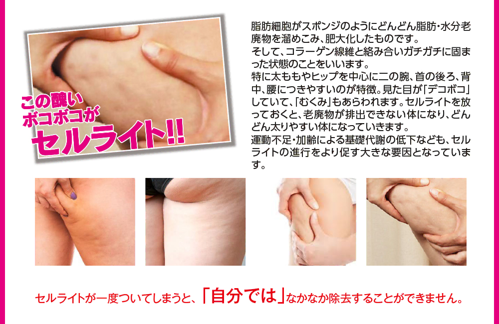 セルライトが一度ついてしまうと｢自分では｣なかなか除去することができません。