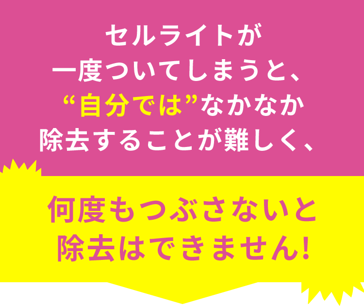 セルライトが一度ついてしまうと、“自分では”なかなか除去することが難しく、何度もつぶさないと除去はできません!