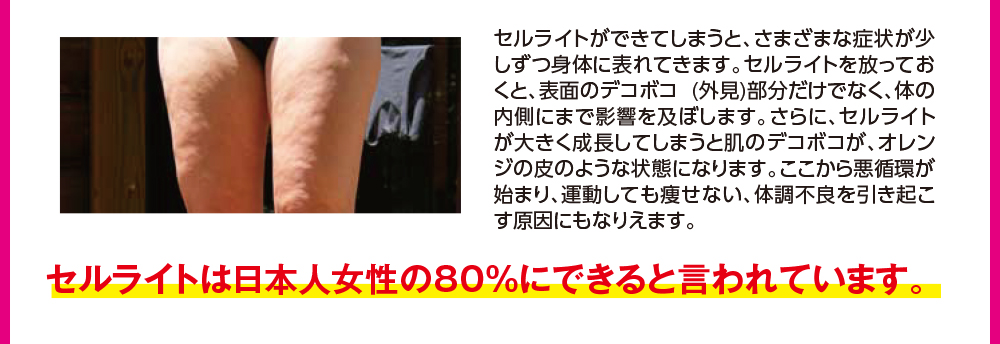 セルライトは日本人の80%にできると言われています。